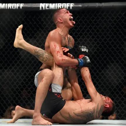 Anthony Pettis profile photo